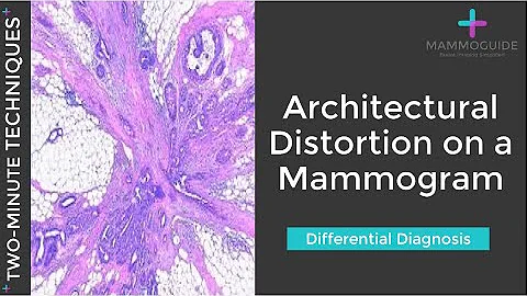 Two Minute Techniques - Architectural Distortion DDx