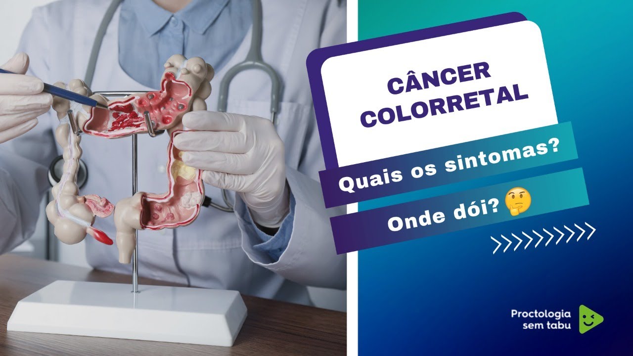Quais os sintomas do câncer de colo retal? Onde dói o câncer colorretal? YouTube Quais os sintomas do câncer de colo retal? Onde dói o câncer colorretal? YouTube
