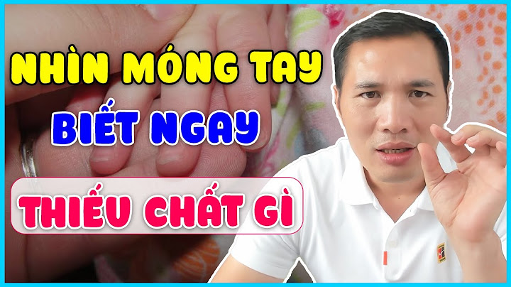 Móng tay bị tách lớp là thiếu chất gì