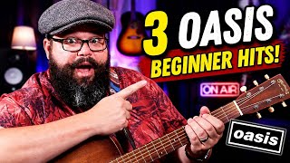 The Ultimate Oasis Starter Pack: 3 Songs Every Beginner Needs