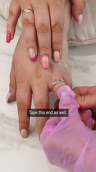 How to remove a ring from swollen finger