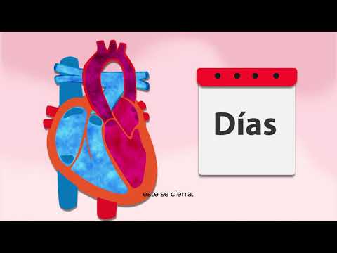 Video: ¿El ibuprofeno afecta el conducto arterioso permeable?