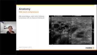 Breast shield sizing:  Translating the evidence by Dr  Danielle Prime