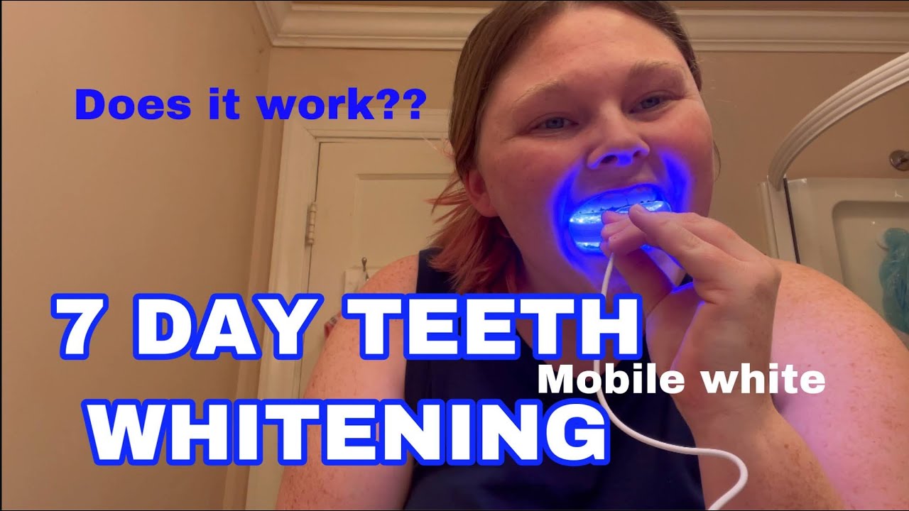 7 Day Teeth Whitening *Does It Work* Mobile White