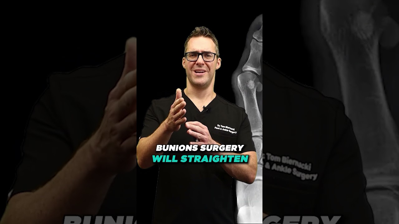 What's a BUNION vs Big Toe Joint vs Arthritis [Bunion Shoes & Bunion Support ]