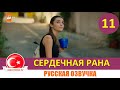 Сердечная рана 11 серия на русском языке (Фрагмент №1)