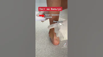 Тест на Вальгус стоп