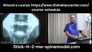 Stick-It-2-Me spine model lumbar medial branch block practice  demonstration