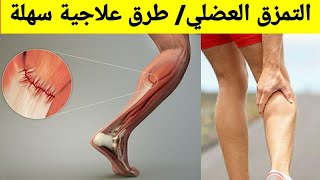 كيفية معالجة التمزق العضلي