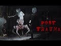 Post Trauma - A Silent Hill Inspired Fixed Camera Survival Horror Game with a Grotesque Crab Lady!