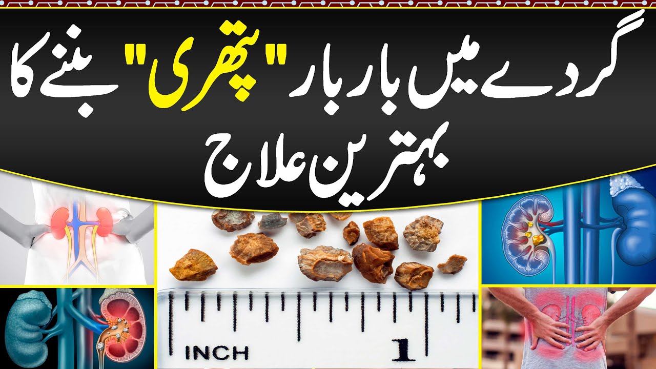 Gurda Ki Pathri Ka Ilaj Kidney Stone Treatment Without Operation gurda-ki-pathri-ka-ilaj-kidney-stone-treatment-without-operation