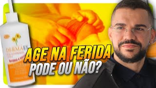 AGE: PODE OU NÃO USAR NA FERIDA? ENTENDA AGORA! (ÓLEO DE GIRASSOL)