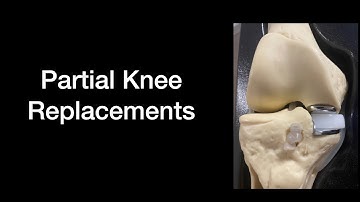 Is Partial Knee Surgery Right For You?