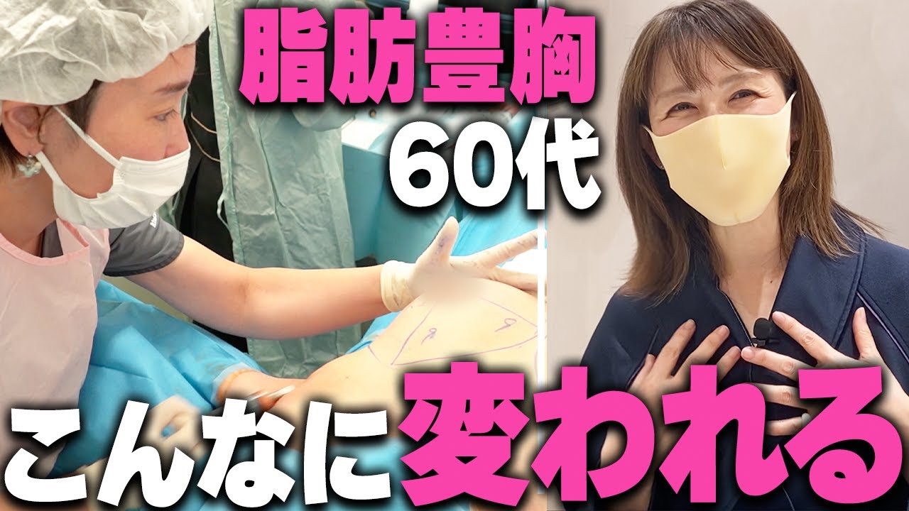 美に定年はなし！人生下り坂の60代、脂肪豊胸で再び若く華々しく！