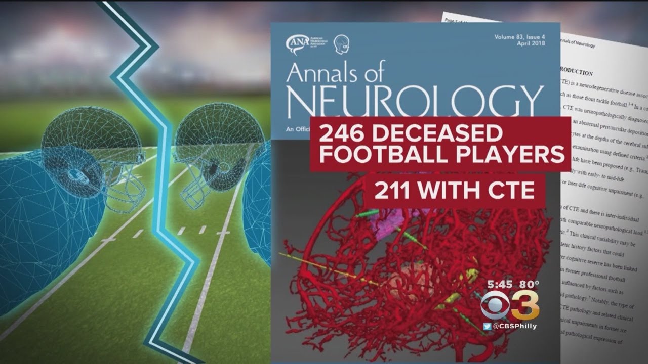 Study: Children Who Play Football Before Age 12 Show CTE-Related Symptoms Much Sooner