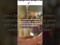 Whiteheads on Chin? | Best Solution with