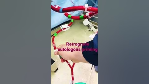 Retrograde autologous Priming of CPB circuit