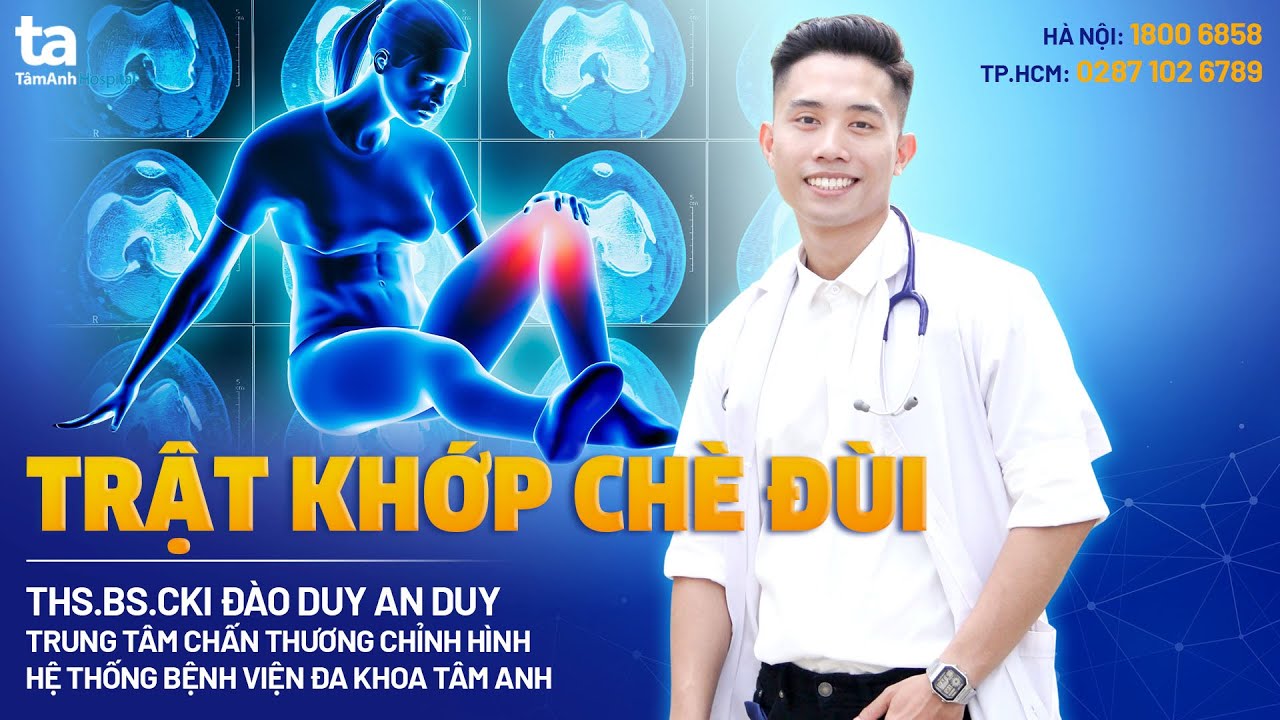 Trật khớp chè đùi (bánh chè): Nguyên nhân, triệu chứng... - youtube