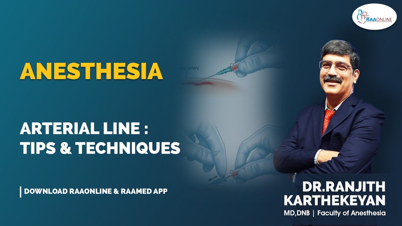 Anesthesia Arterial line Tips & techniques YouTube