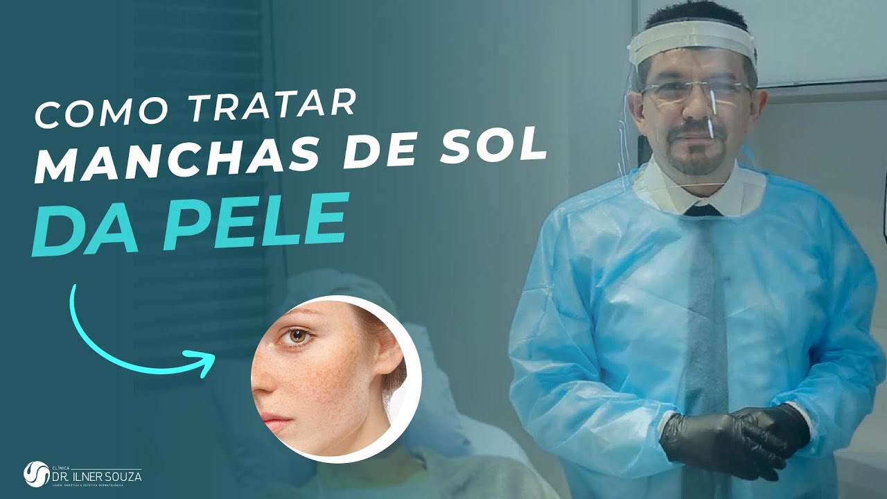 Como tratar as manchas de sol da pele - YouTube