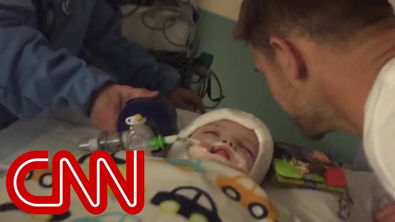 Conjoined twins after surgery Separated and a success YouTube Conjoined twins after surgery Separated and a success YouTube