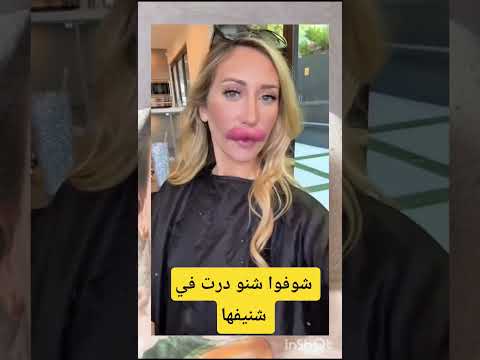 شوفو على حالة درت في شنايفها