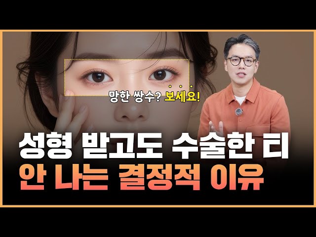 내 성형수술이 남들보다 티가 나는 결정적인 이유!