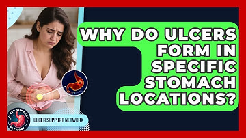 Why Do Ulcers Form In Specific Stomach Locations? - Ulcer Support Network