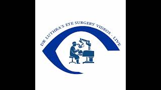 Post-Femto Cataract Surgery with Phaco 🔴LIVE | Toric II IOL #eyesurgery #cataract #drishti