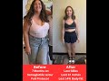 Shayna's Testimonial of the Paradise Valley Trim Clinic - YouTube