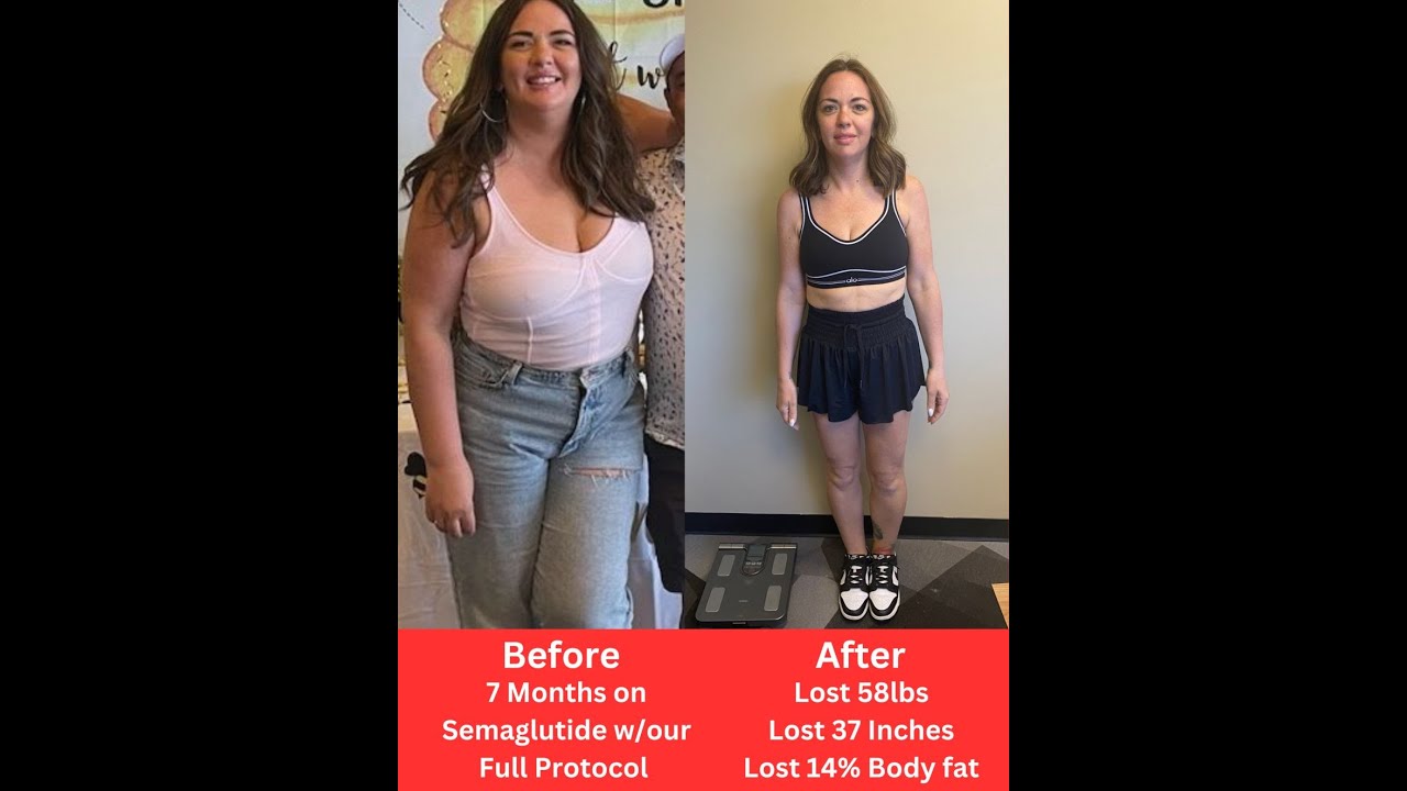 medical spa semaglutide Injectable Medical Weightloss – Plaza Aesthetics & Wellness medical spa semaglutide Injectable Medical Weightloss – Plaza Aesthetics & Wellness