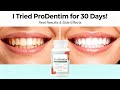 ProDentim Review 2025 – I Tried It for 30 Days! Real Oral Health Results & Side Effects