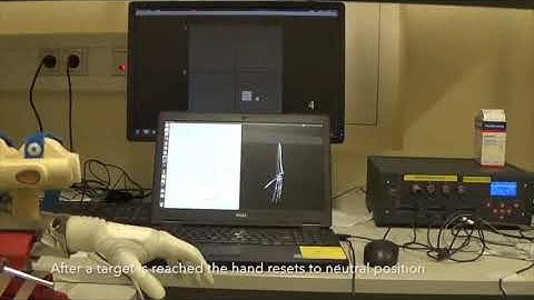 Real-time EMG-driven musculoskeletal model of the phantom limb for prosthesis model-based myocontrol