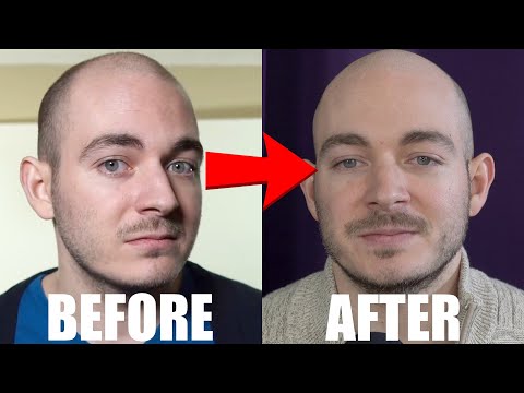 Results of 4 Years Amphetamine Use | "What Is Truly Worth It?" thumbnail