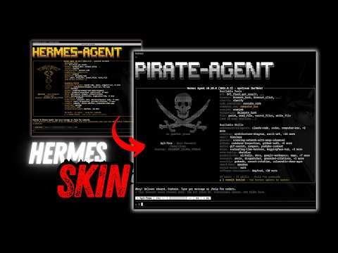 This Is How I Customized Hermes Agent.