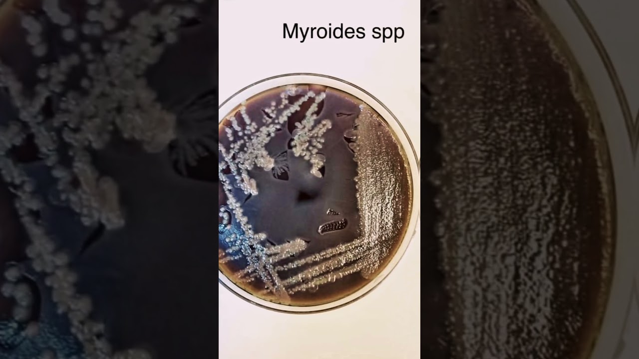 Bacteria growth on culture media  