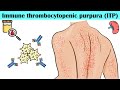 Immune Thrombocytopenic Purpura (ITP) - Causes, Pathogenesis, Signs & Symptoms, Diagnosis, Treatment