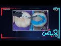 أنواع الحشو التجميلي للأسنان وشرح العملية كاملة بالفيديو | د. أحمد اسكندر