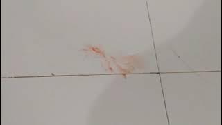 Cara menyucikan najis darah di lantai