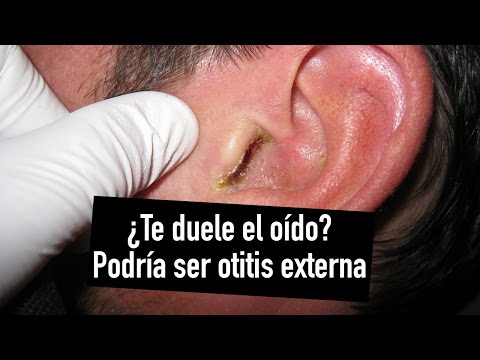 Video: ¿Por qué me duele la parte exterior del oído?