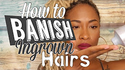 5 Steps to BANISH Ingrown Hairs that WORKS