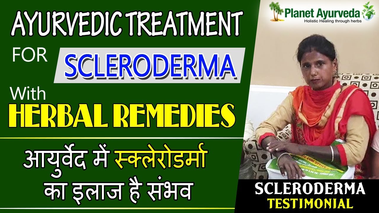 Watch Video Successful Treatment of Scleroderma at Best Ayurvedic Center in India