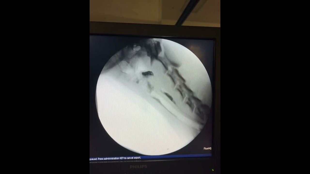 Barium Swallow Test - Cormac the Golden Retriever