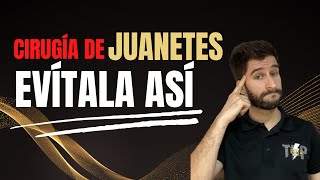 ❌Cirugía de juanetes. Evítala con estos ejercicios para Hallux Valgus