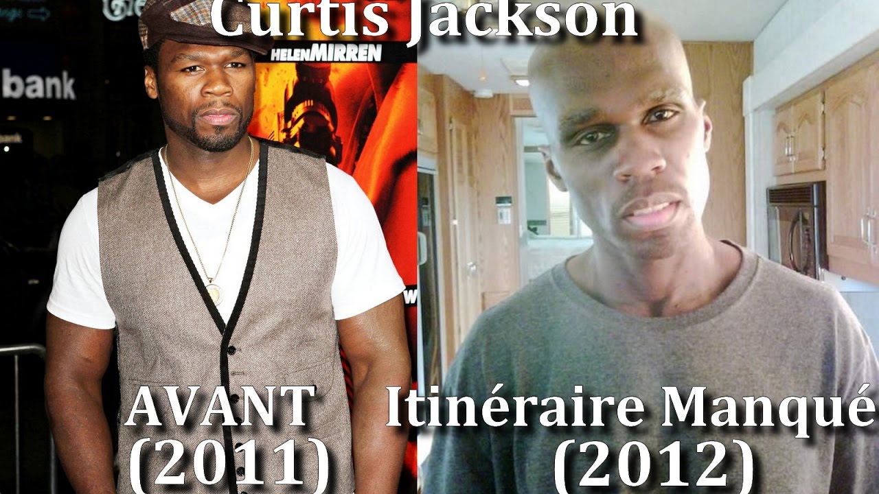 before and after braces 36 Acteurs Qui Ont Subi Une Transformation Physique Extrême Pour Jouer Dans Un Film