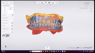 Reference Denture Intraoral Scans