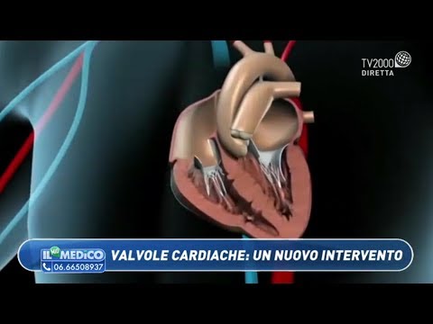 Video: Restringimento Della Valvola Cardiaca (aortica) Nei Gatti