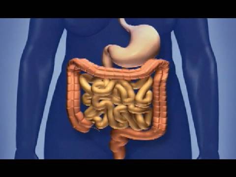 Screening for Colorectal Cancer