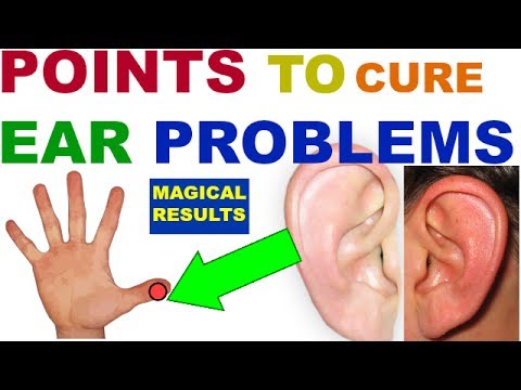 Acupuncture For Tinnitus: What You Need To Know | Jolt PEMF Lab In AZ