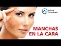 CAUSAS y TRATAMIENTO del las MANCHAS CAFÉ en la CARA 🙈🙉🙊 MELASMA MALAR 🤦‍♀️ ETERNA JUVENTUD